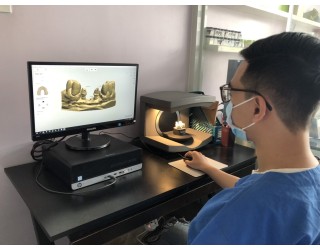 SCAN DẤU HÀM 3D 4.0