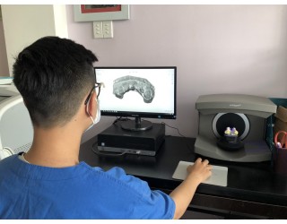 SCAN DẤU HÀM 3D 4.0